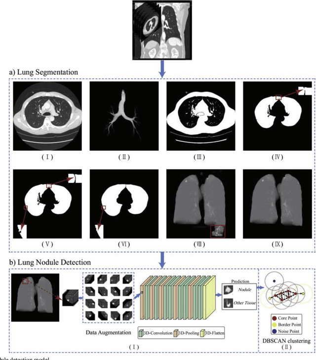 Figure 1 for Application of Computer Deep Learning Model in Diagnosis of Pulmonary Nodules