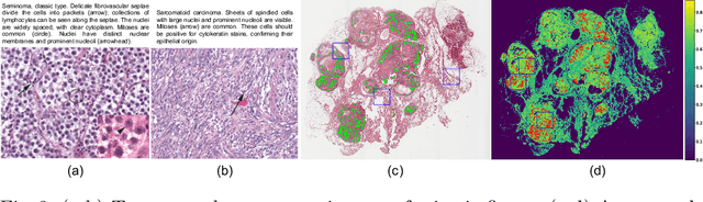 Figure 3 for Leveraging image captions for selective whole slide image annotation