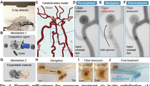 Figure 4 for Magnetic Milli-spinner for Robotic Endovascular Surgery