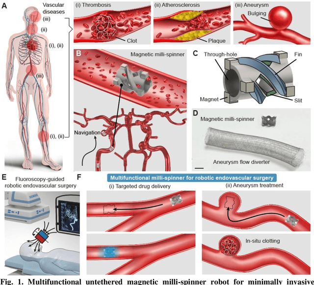 Figure 1 for Magnetic Milli-spinner for Robotic Endovascular Surgery