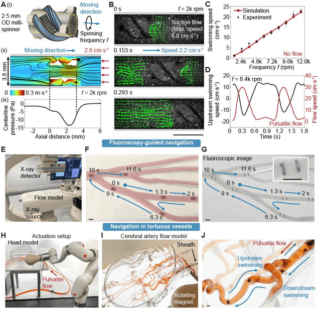 Figure 2 for Magnetic Milli-spinner for Robotic Endovascular Surgery