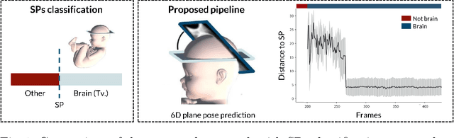 Figure 1 for Measuring proximity to standard planes during fetal brain ultrasound scanning