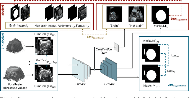 Figure 3 for Measuring proximity to standard planes during fetal brain ultrasound scanning