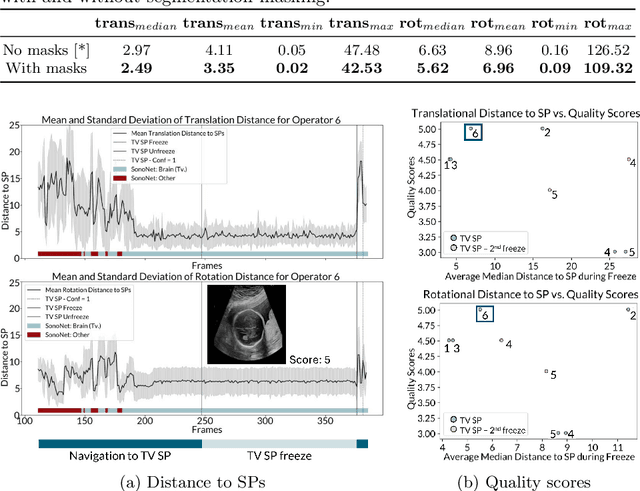 Figure 4 for Measuring proximity to standard planes during fetal brain ultrasound scanning