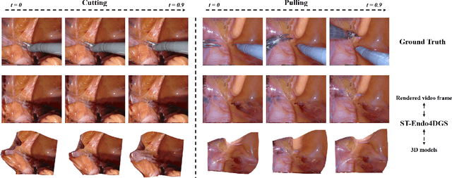 Figure 3 for Real-Time Spatio-Temporal Reconstruction of Dynamic Endoscopic Scenes with 4D Gaussian Splatting