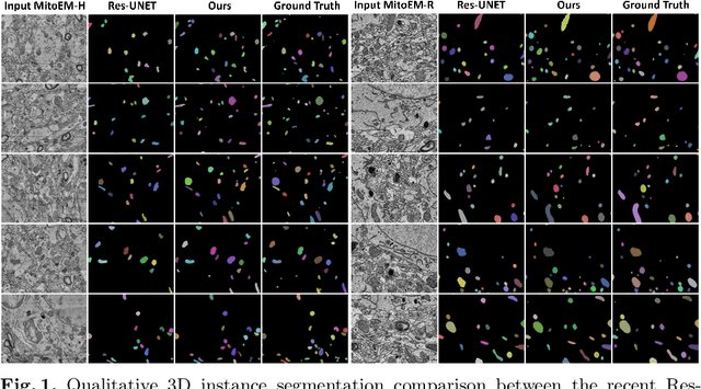 Figure 1 for 3D Mitochondria Instance Segmentation with Spatio-Temporal Transformers