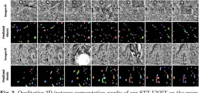 Figure 4 for 3D Mitochondria Instance Segmentation with Spatio-Temporal Transformers