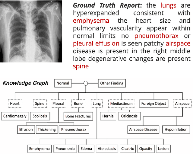 Figure 1 for Medical Report Generation Is A Multi-label Classification Problem