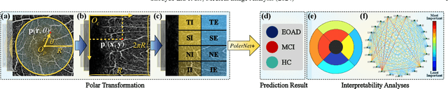 Figure 3 for Beyond the Eye: A Relational Model for Early Dementia Detection Using Retinal OCTA Images