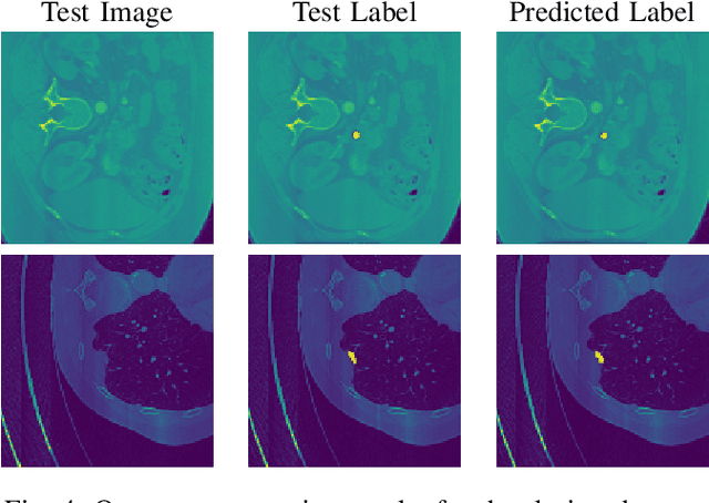 Figure 4 for Optimizing Universal Lesion Segmentation: State Space Model-Guided Hierarchical Networks with Feature Importance Adjustment