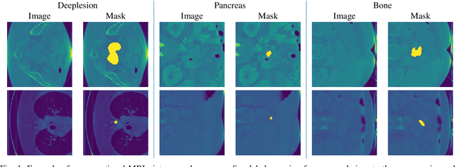 Figure 1 for Optimizing Universal Lesion Segmentation: State Space Model-Guided Hierarchical Networks with Feature Importance Adjustment