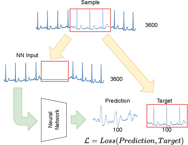 Figure 3 for Classification and Self-Supervised Regression of Arrhythmic ECG Signals Using Convolutional Neural Networks