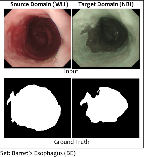 Figure 1 for SUPRA: Superpixel Guided Loss for Improved Multi-modal Segmentation in Endoscopy