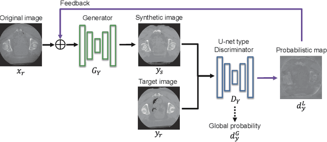 Figure 1 for Feedback Assisted Adversarial Learning to Improve the Quality of Cone-beam CT Images