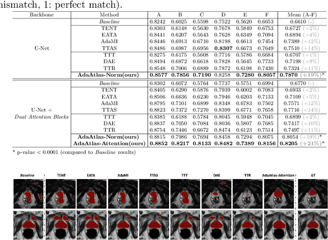 Figure 2 for Pay Attention to the Atlas: Atlas-Guided Test-Time Adaptation Method for Robust 3D Medical Image Segmentation