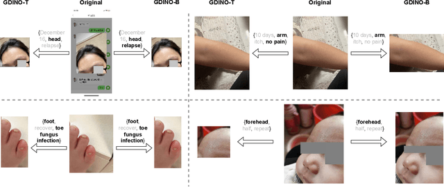 Figure 3 for ZALM3: Zero-Shot Enhancement of Vision-Language Alignment via In-Context Information in Multi-Turn Multimodal Medical Dialogue