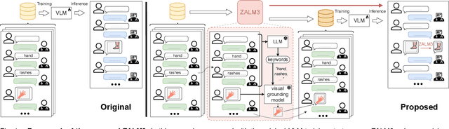 Figure 1 for ZALM3: Zero-Shot Enhancement of Vision-Language Alignment via In-Context Information in Multi-Turn Multimodal Medical Dialogue