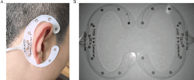 Figure 1 for Using Ear-EEG to Decode Auditory Attention in Multiple-speaker Environment