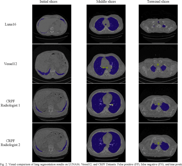 Figure 2 for Lung-Net: A deep learning framework for lung tissue segmentation in three-dimensional thoracic CT images