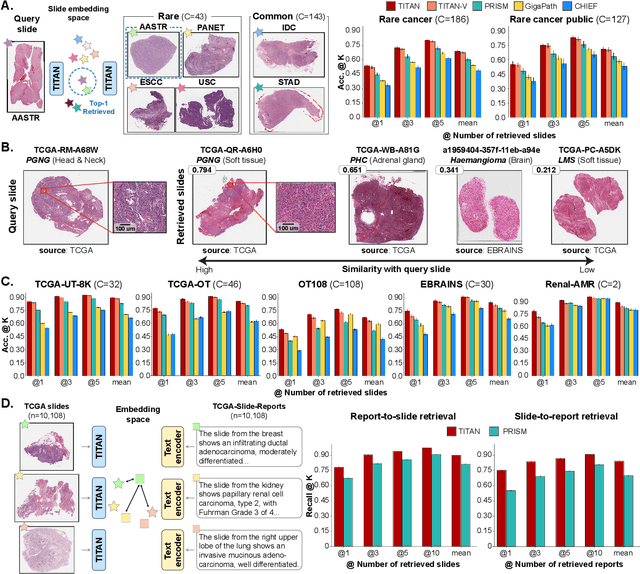 Figure 4 for Multimodal Whole Slide Foundation Model for Pathology