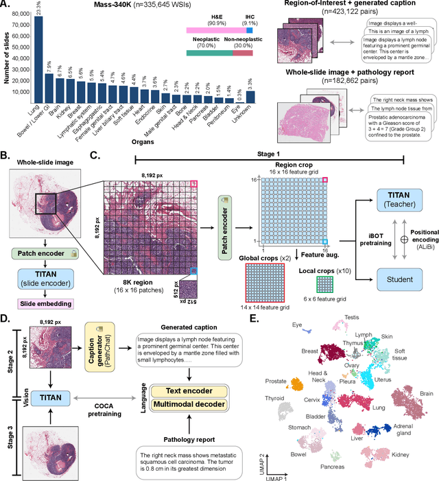 Figure 1 for Multimodal Whole Slide Foundation Model for Pathology