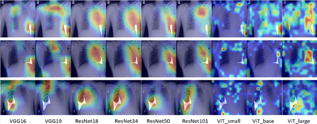 Figure 2 for Is visual explanation with Grad-CAM more reliable for deeper neural networks? a case study with automatic pneumothorax diagnosis