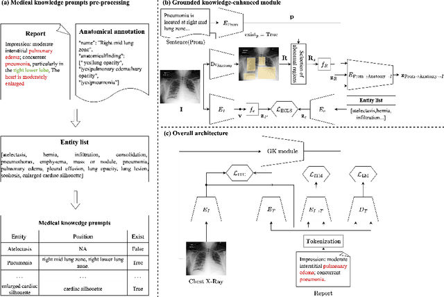 Figure 1 for Grounded Knowledge-Enhanced Medical VLP for Chest X-Ray