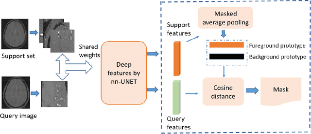 Figure 1 for VesselShot: Few-shot learning for cerebral blood vessel segmentation