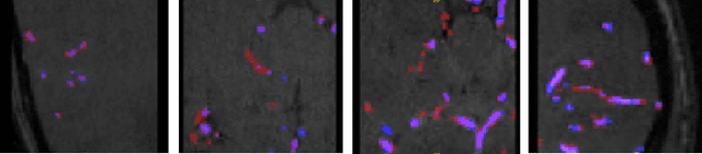 Figure 3 for VesselShot: Few-shot learning for cerebral blood vessel segmentation