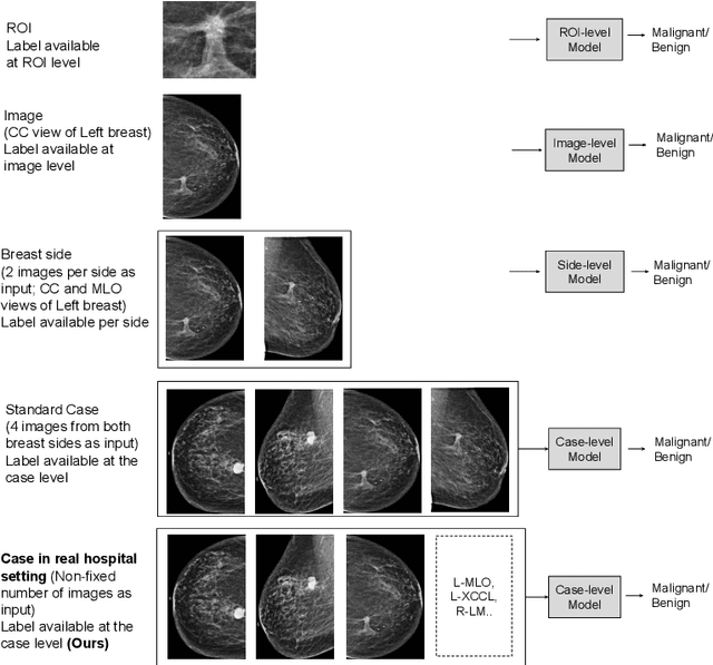Figure 1 for Weakly Supervised Learning for Breast Cancer Prediction on Mammograms in Realistic Settings