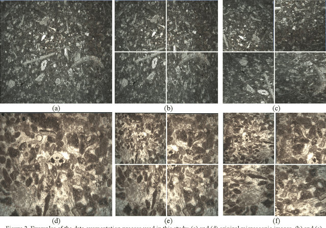 Figure 4 for FTA-FTL: A Fine-Tuned Aggregation Federated Transfer Learning Scheme for Lithology Microscopic Image Classification