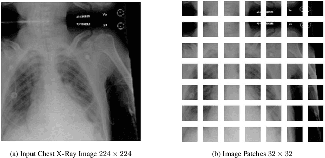 Figure 3 for A Comparative Study of CNN, ResNet, and Vision Transformers for Multi-Classification of Chest Diseases