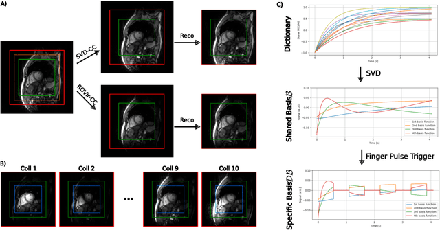 Figure 2 for Self Supervised Learning for Improved Calibrationless Radial MRI with NLINV-Net