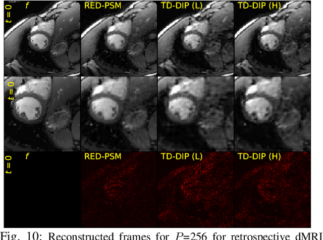 Figure 2 for RED-PSM: Regularization by Denoising of Partially Separable Models for Dynamic Imaging