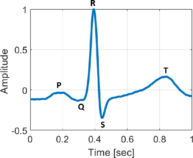 Figure 1 for ECG-TEM: Time-based sub-Nyquist sampling for ECG signal reconstruction and Hardware Prototype