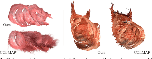 Figure 1 for ToDER: Towards Colonoscopy Depth Estimation and Reconstruction with Geometry Constraint Adaptation