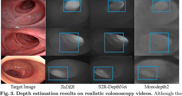 Figure 4 for ToDER: Towards Colonoscopy Depth Estimation and Reconstruction with Geometry Constraint Adaptation