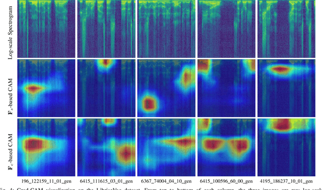 Figure 4 for Robust AI-Synthesized Speech Detection Using Feature Decomposition Learning and Synthesizer Feature Augmentation