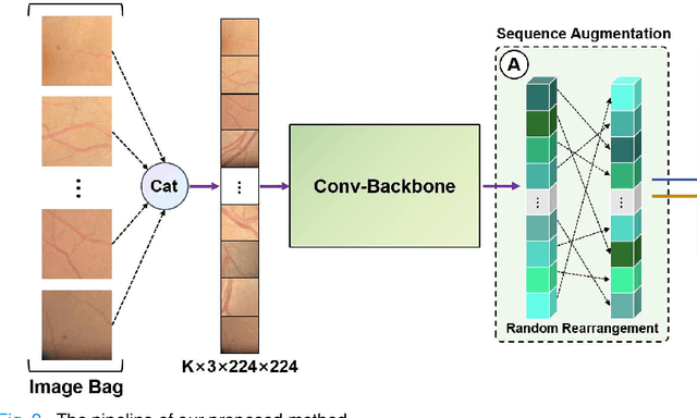 Figure 2 for Eye tracking guided deep multiple instance learning with dual cross-attention for fundus disease detection