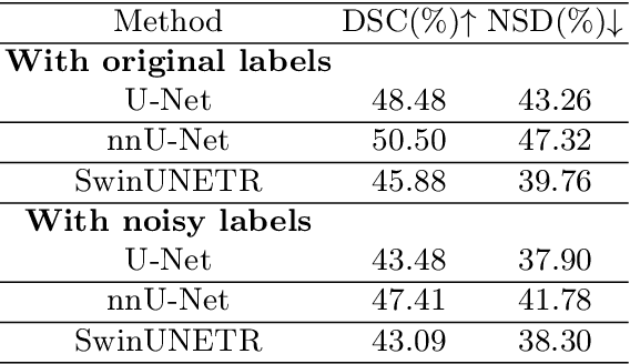 Figure 4 for Optimizing Synthetic Data for Enhanced Pancreatic Tumor Segmentation