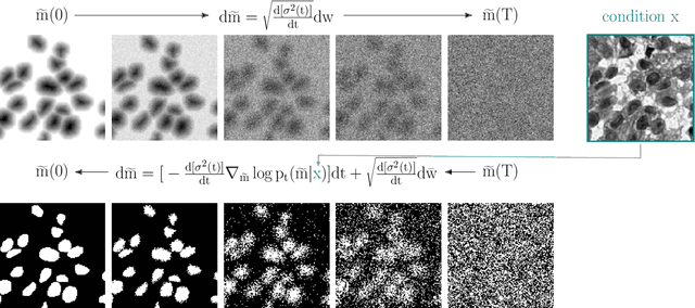 Figure 1 for Score-Based Generative Models for Medical Image Segmentation using Signed Distance Functions