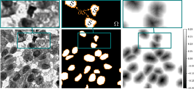 Figure 3 for Score-Based Generative Models for Medical Image Segmentation using Signed Distance Functions