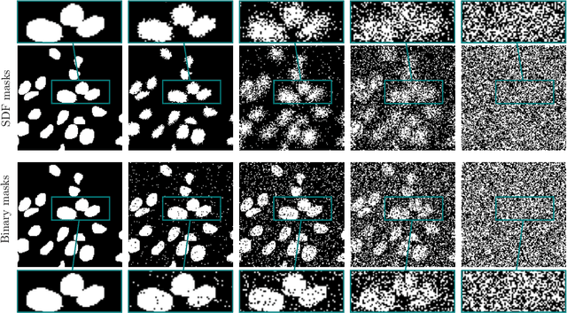 Figure 4 for Score-Based Generative Models for Medical Image Segmentation using Signed Distance Functions