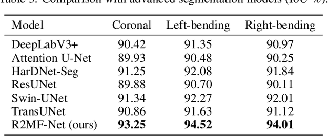 Figure 3 for R2MF-Net: A Recurrent Residual Multi-Path Fusion Network for Robust Multi-directional Spine X-ray Segmentation