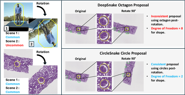 Figure 1 for Circle Representation for Medical Instance Object Segmentation