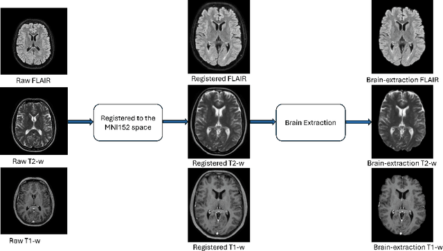 Figure 2 for ICPR 2024 Competition on Multiple Sclerosis Lesion Segmentation -- Methods and Results