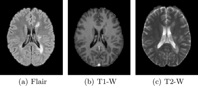 Figure 3 for ICPR 2024 Competition on Multiple Sclerosis Lesion Segmentation -- Methods and Results