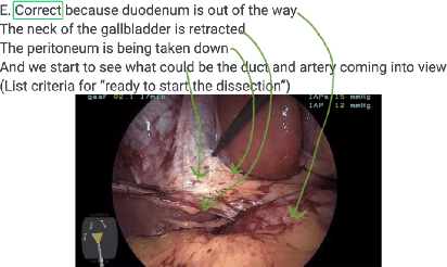 Figure 2 for Surgment: Segmentation-enabled Semantic Search and Creation of Visual Question and Feedback to Support Video-Based Surgery Learning