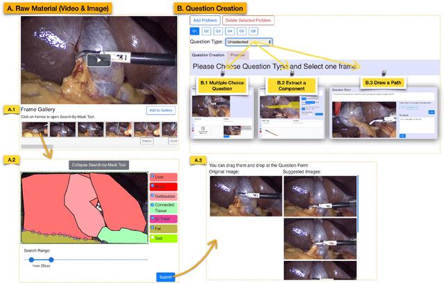 Figure 4 for Surgment: Segmentation-enabled Semantic Search and Creation of Visual Question and Feedback to Support Video-Based Surgery Learning