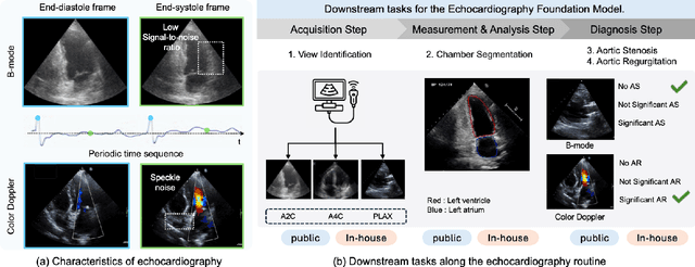 Figure 1 for EchoFM: Foundation Model for Generalizable Echocardiogram Analysis